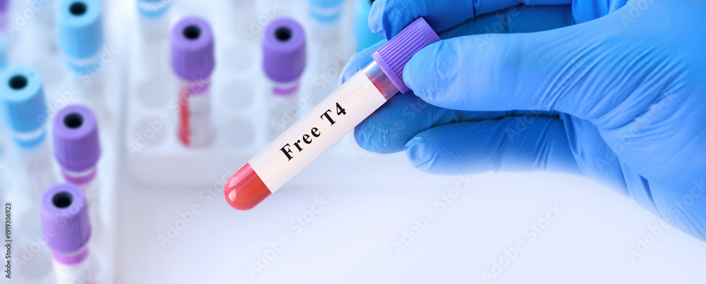 Naklejka premium Doctor holding free T4 blood test tube explaining evaluation of active thyroxine hormone levels, thyroid function regulation and diagnosis of thyroid disorders in clinical laboratory diagnostics
