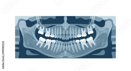 A panoramic dental X-ray of a human jaw, clearly showing teeth, roots, and bone.