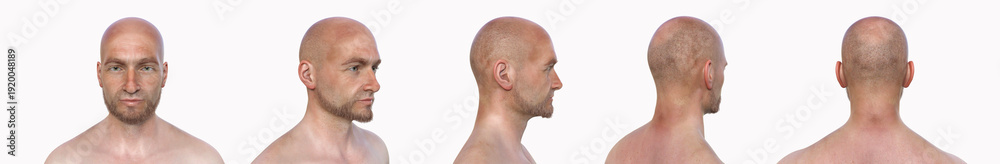 Obraz premium Third brain ventricle, 3D illustration