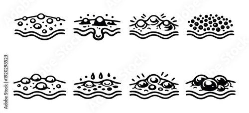 Skin pore and acne progression icons on gray background