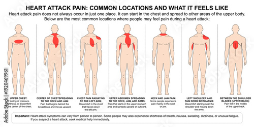 Heart Attack Pain- Common Locations and What It Feels Like