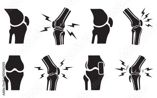 Human Knee Illustration Set – Healthy and Injured Joint Anatomy Comparison VectorWeb