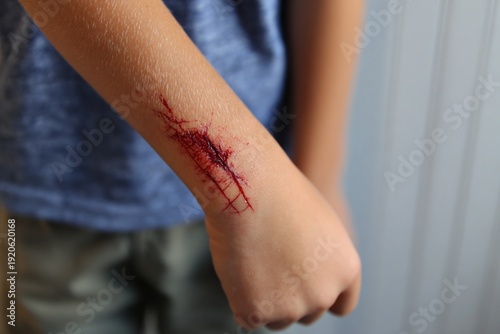 A child's arm cut and bleeding, a concept of healthcare