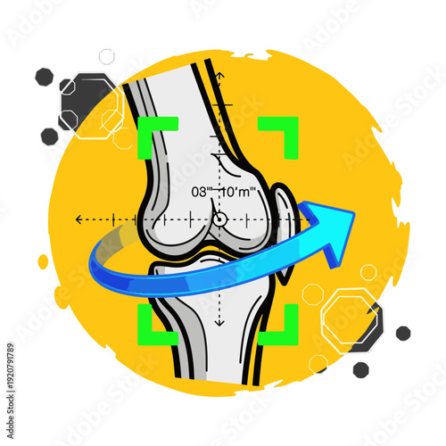Knee anatomy diagram with measurement and blue arrow on yellow background