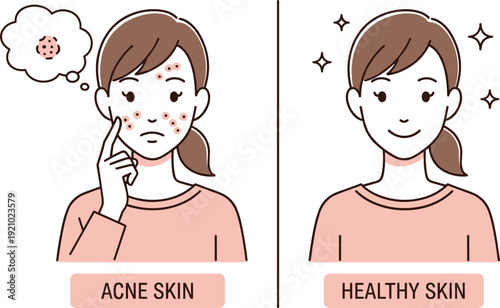 Comparison of acne skin and healthy skin on female face, dermatology and skincare treatment concept illustrating blemish prevention, beauty care, and clear complexion improvement