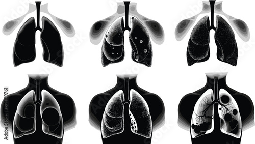 Human lungs with various diseases and conditions lung disease medical respiratory system