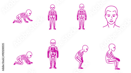 human skeletal development stages illustrating bone health growth and rickets progression medical science diagram.