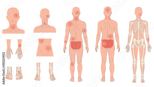 Comprehensive human body pain map illustrating areas of discomfort on various body parts and the skeletal system, useful for medical and health diagnoses.