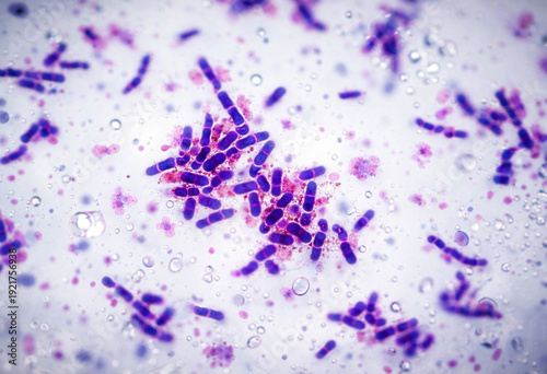 bacteria seen under a microscope