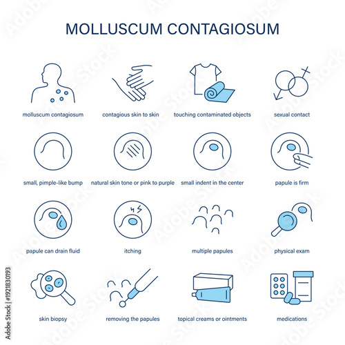 Molluscum Contagiosum symptoms, diagnostic and treatment vector icon set