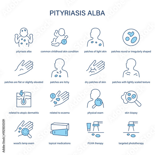 Pityriasis Alba symptoms, diagnostic and treatment vector icon set
