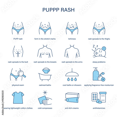 PUPPP Rash symptoms, diagnostic and treatment vector icon set