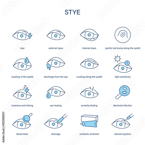 Stye symptoms, diagnostic and treatment vector icon set