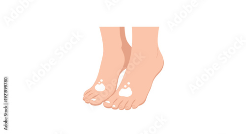 A pair of light-skinned human feet are shown with white patches on the toes and top, indicating a skin condition.