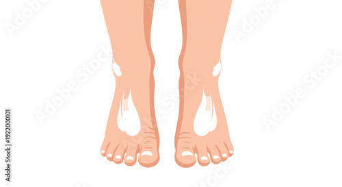 A front view of human feet displays large prominent white patches on the insteps and ankles, suggesting a skin disorder.