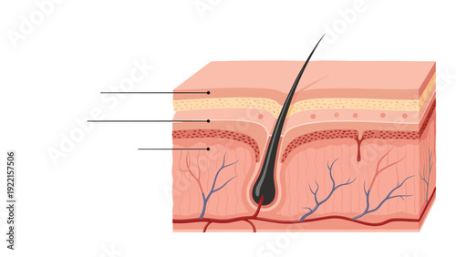 Anatomical cross-section diagram of human skin layers, including the epidermis, dermis, and hair follicle, for medical education.