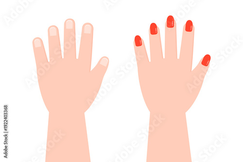 Red nail polish fingernail before and after comparison. Beauty, self care, manicure concept. Flat vector design isolated illustration. 