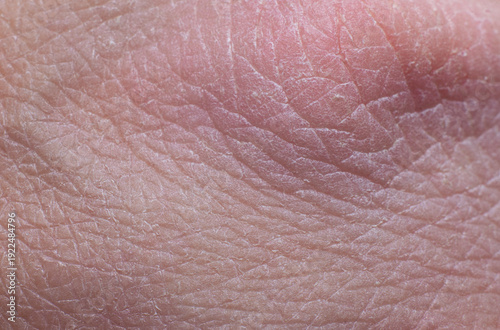 Macro fragment of skin on a human hand.