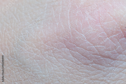 Macro fragment of skin on a human hand.