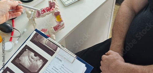 Foto Treatment cancer colon