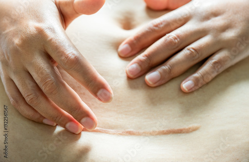 Obraz na płótnie Close-up of a healed C-section scar on a woman's belly with a hand gently touching the skin