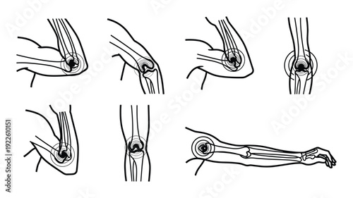 Elbow joint anatomy line art drawings set showcasing different arm positions