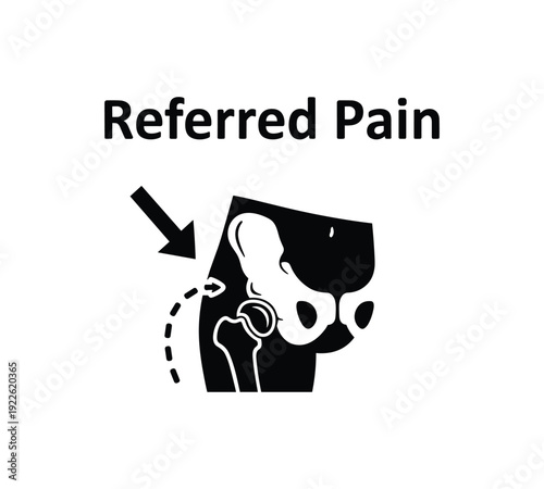 Referred pain diagram showing hip joint anatomy and pain location.