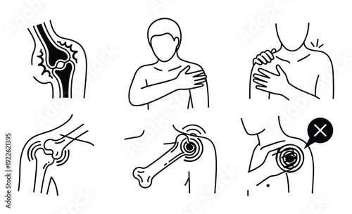 Shoulder Pain Body Aches Joint Pain Anatomy Illustration