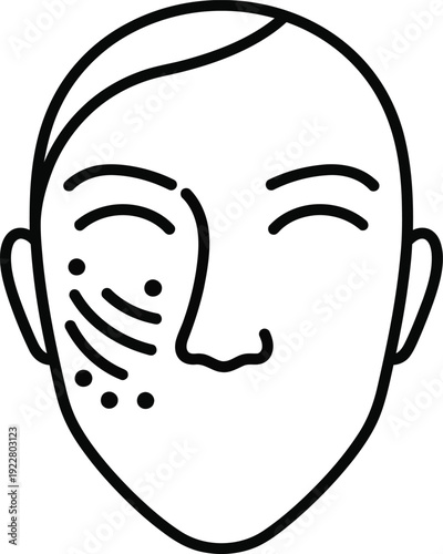 Facial diagram with acupuncture points