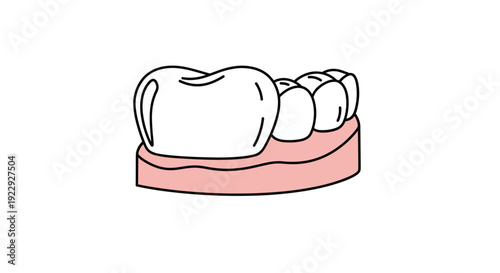 Dental Crown and Molars on Gum Line
