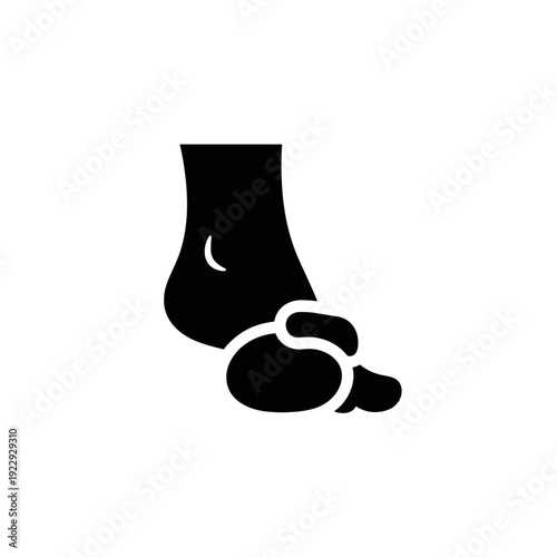 Silhouette Of A Foot With A Bunions