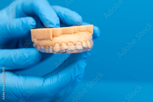 Custom transparent dental night mouth guard for night sleep, bruxism and teeth grinding prevention, orthodontic protection device fitted  on teeth model, orthodontic device. Blue background