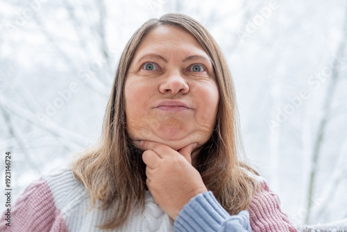 Tableau sur toile Closeup female double chin and neck fat, obesity overweight condition, aesthetic