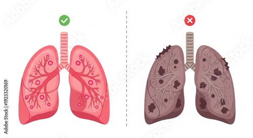 Healthy versus unhealthy lungs with bronchial tubes comparing normal and damaged respiratory system