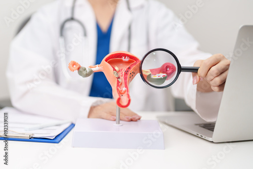 Tableau sur toile Doctor with Uterus and Ovaries anatomy model