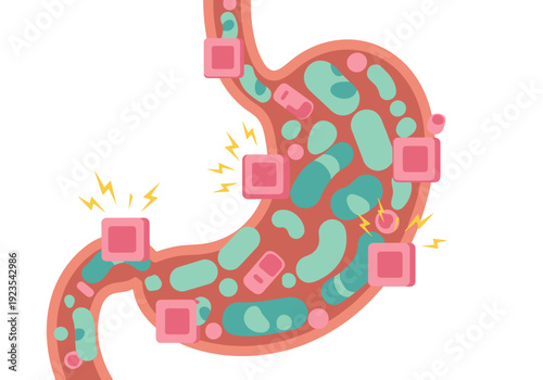 Illustrative depiction of a stomach's microbiome ecosystem, showcasing bacterial activity and potential inflammation. Vibrant colors and a modern style.