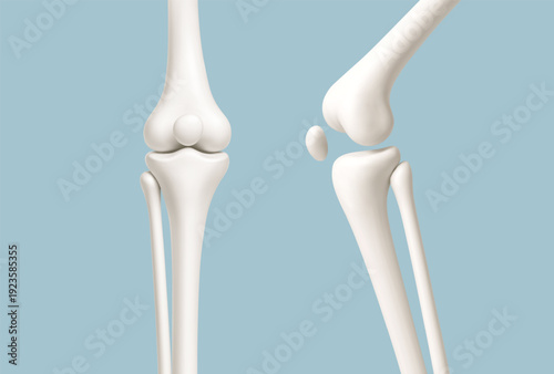 Human knee joint anatomy models showing straight and bent positions isolated on blue background. Medical or healthcare concept. Vector illustration