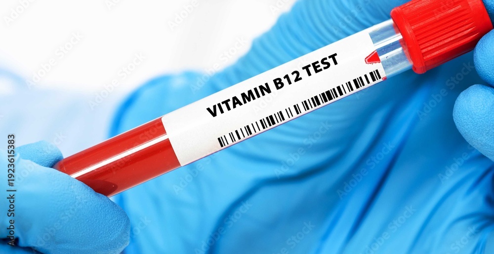 Naklejka premium Vitamin B12 Test