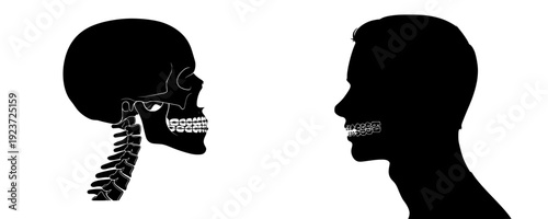 Silhouette of a skeletal skull with braces, side profile, dental implant