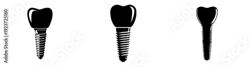 Dental implant intricacy: A closer look at the titanium screw