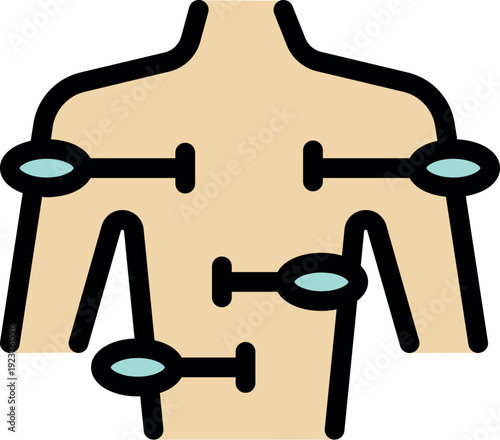 Body with acupuncture needles inserted, representing alternative medicine and pain relief techniques
