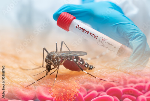 Dengue Virus Discovery: The scientific exploration of dengue fever, a mosquito bites on human skin revealing microscopic detail and a medical vial containing the virus sample. 