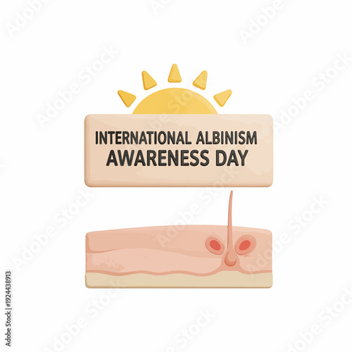 International Albinism Awareness Day Sign.