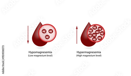 Hypermagnesemia, high plasma magnesium level and hypomagnesemia, low plasma magnesium level. magnesium Mg excess and deficit electrolyte disorders, blood test tube, Scientific vector illustration.