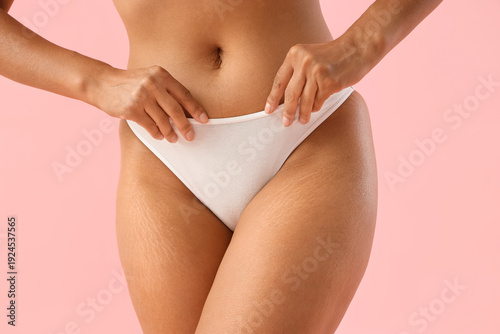 Bild auf Leinwand Young woman in underwear with stretch marks on pink background, closeup