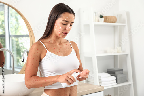 Young woman ill with chicke...