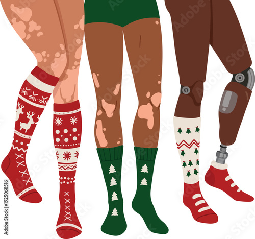 Diverse Legs In Festive Socks With Vitiligo And Prosthetic Limb
