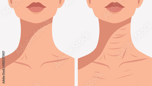 Creases on the neck. Vector illustration, young and aged skin of neck and face. Smooth, taut skin, wrinkles, sagging, loss volume. For anti-aging products, skin care, cosmetic surgery