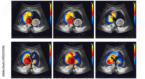 Series of medical scans showing heart chambers and blood flow from various viewpoints