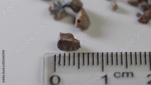 fragments of a kidney stone broken by an ultrasound wave against the background of a centimeter measuring ruler